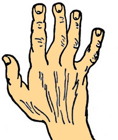 spatulate shape hand